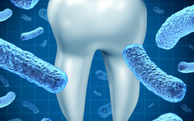 What is Periodontal (Gum) Disease Bacteria?